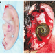Illustration for article titled Surgeons use leeches to help reattach ear